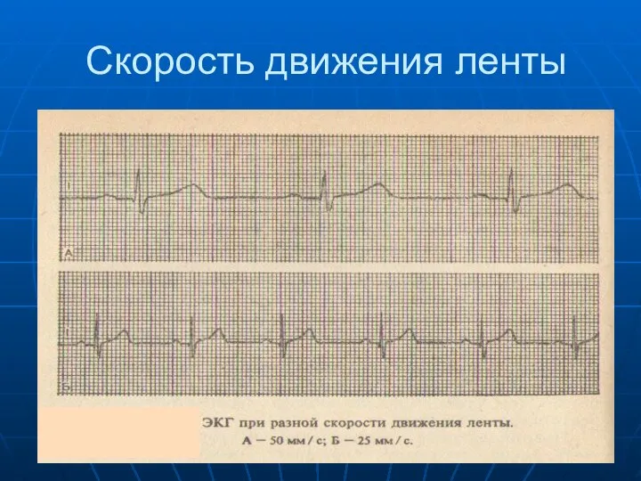 Скорость движения ленты