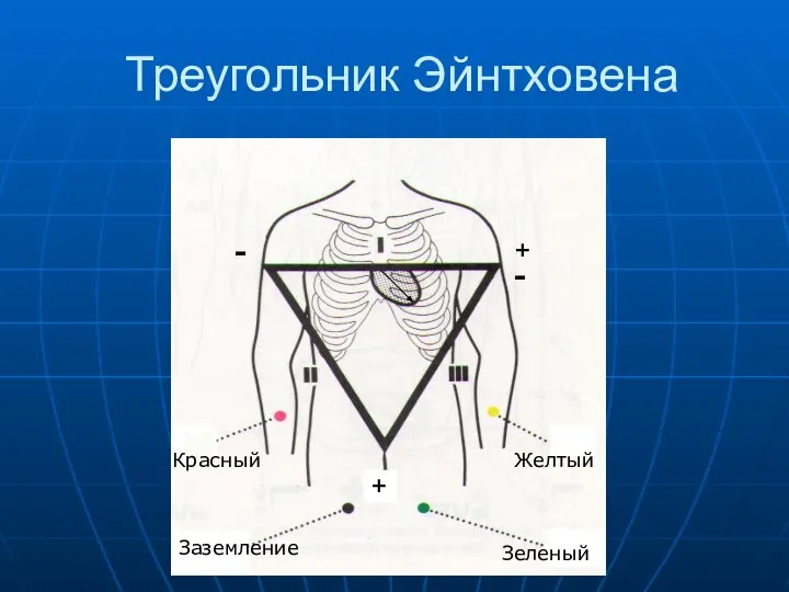 Треугольник Эйнтховена Красный Заземление Желтый Зеленый - + - +