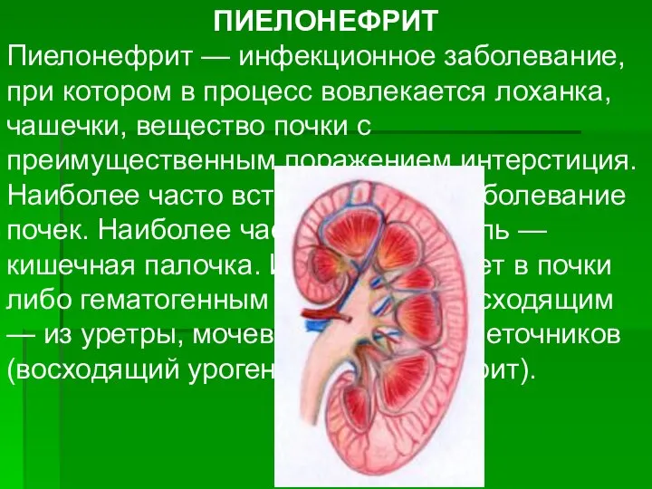 ПИЕЛОНЕФРИТ Пиелонефрит — инфекционное заболевание, при котором в процесс вовлекается лоханка,