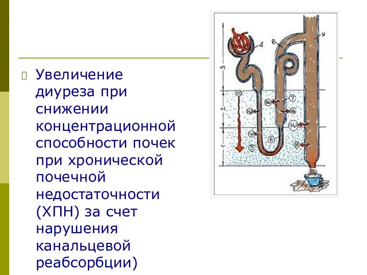 Увеличение диуреза при снижении концентрационной способности почек при хронической почечной недостаточности