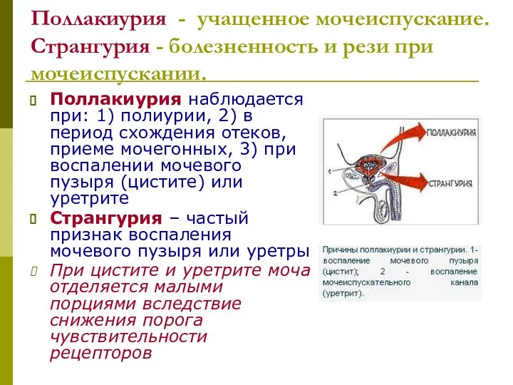 Поллакиурия - учащенное мочеиспускание. Странгурия - болезненность и рези при мочеиспускании.