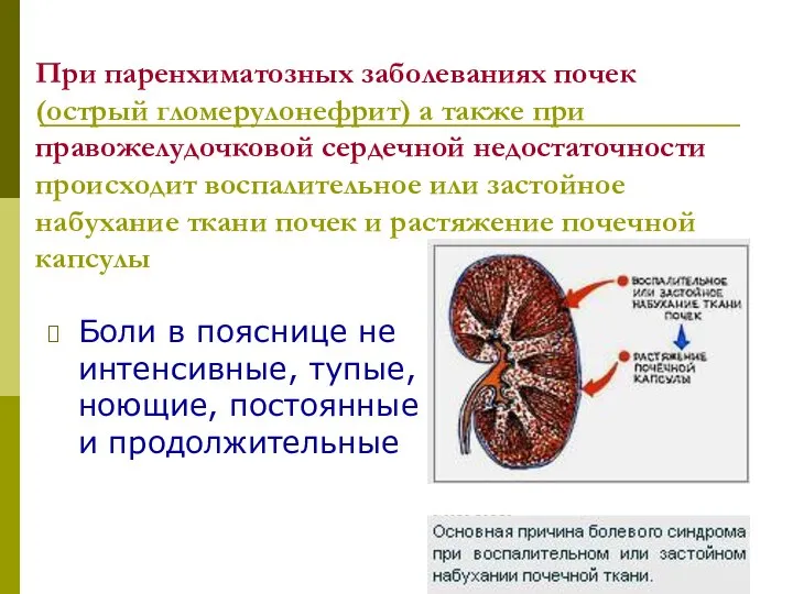 При паренхиматозных заболеваниях почек (острый гломерулонефрит) а также при правожелудочковой сердечной