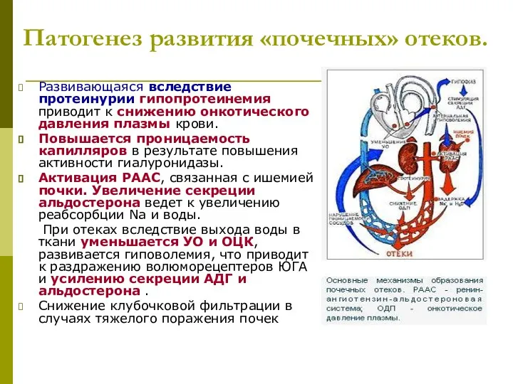 Патогенез развития «почечных» отеков. Развивающаяся вследствие протеинурии гипопротеинемия приводит к снижению