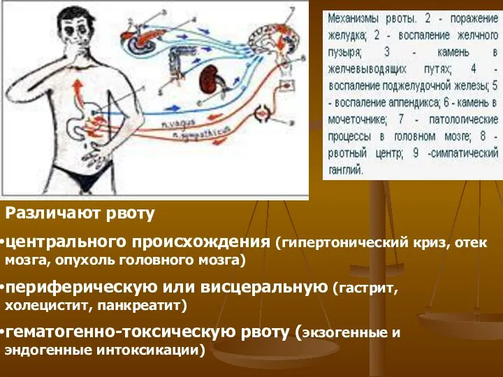 Различают рвоту центрального происхождения (гипертонический криз, отек мозга, опухоль головного мозга)