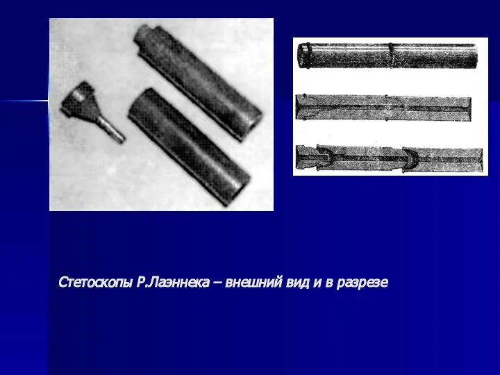 Стетоскопы Р.Лаэннека – внешний вид и в разрезе