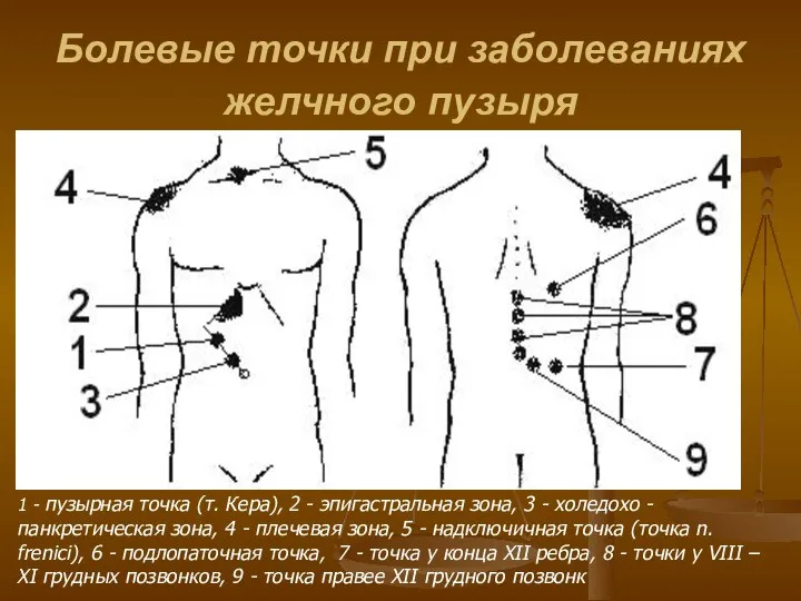 Болевые точки при заболеваниях желчного пузыря 1 - пузырная точка (т.