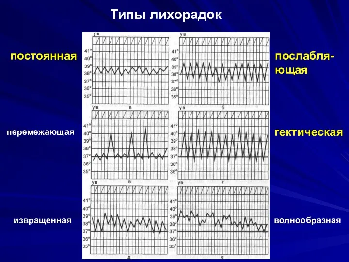 постоянная послабля-ющая перемежающая гектическая извращенная волнообразная Типы лихорадок