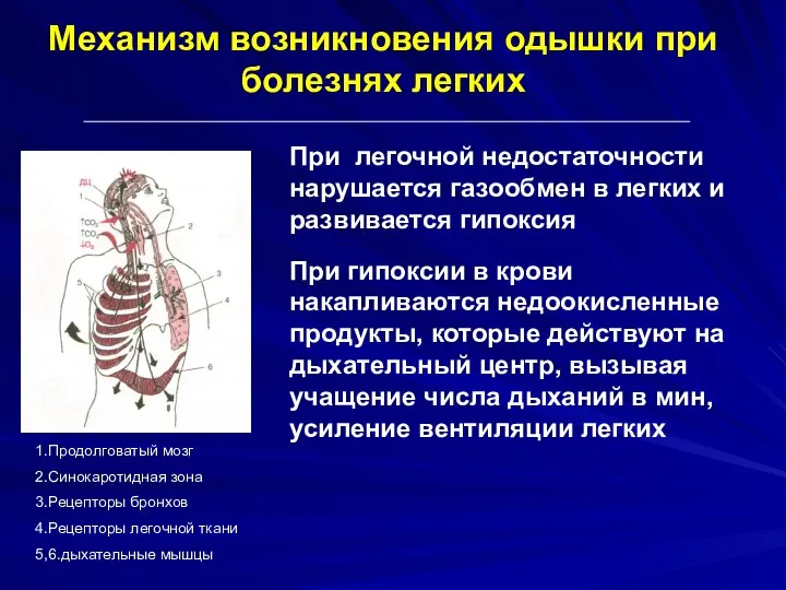 Механизм возникновения одышки при болезнях легких 1.Продолговатый мозг 2.Синокаротидная зона 3.Рецепторы