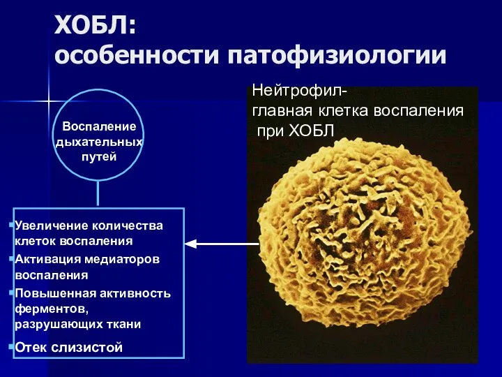 Воспаление дыхательных путей Увеличение количества клеток воспаления Активация медиаторов воспаления Повышенная