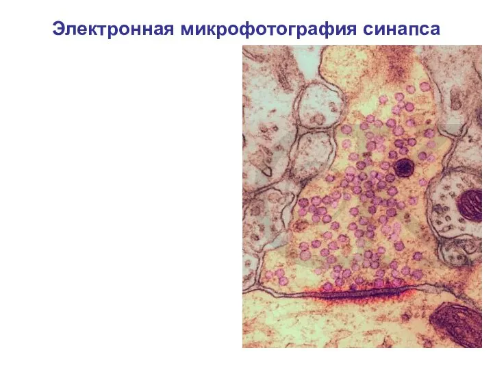 Электронная микрофотография синапса