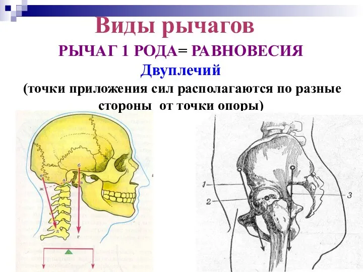 Виды рычагов РЫЧАГ 1 РОДА= РАВНОВЕСИЯ Двуплечий (точки приложения сил располагаются