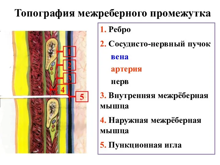 Топография межреберного промежутка 1. Ребро 2. Сосудисто-нервный пучок вена артерия нерв
