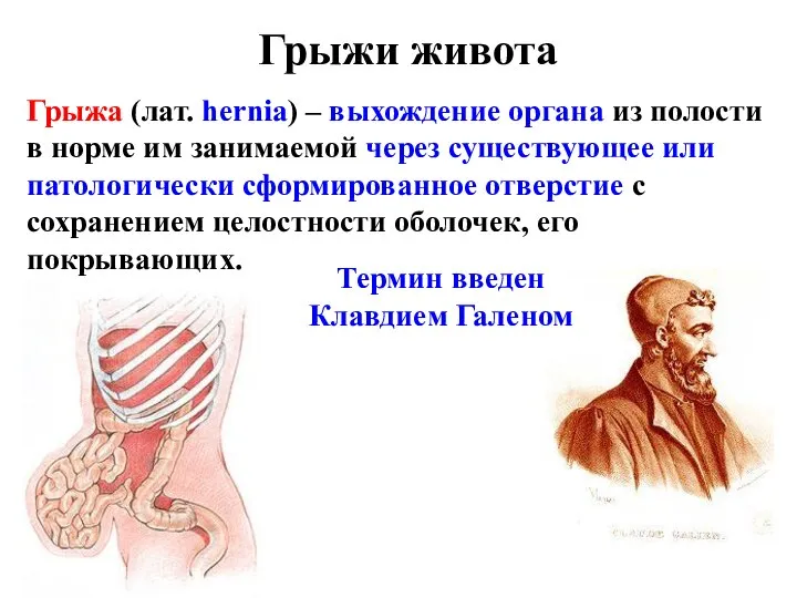 Грыжи живота Грыжа (лат. hernia) – выхождение органа из полости в