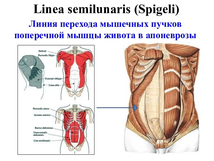 Линия перехода мышечных пучков поперечной мышцы живота в апоневрозы Linea semilunaris (Spigeli)