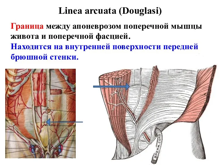 Linea arcuata (Douglasi) Граница между апоневрозом поперечной мышцы живота и поперечной