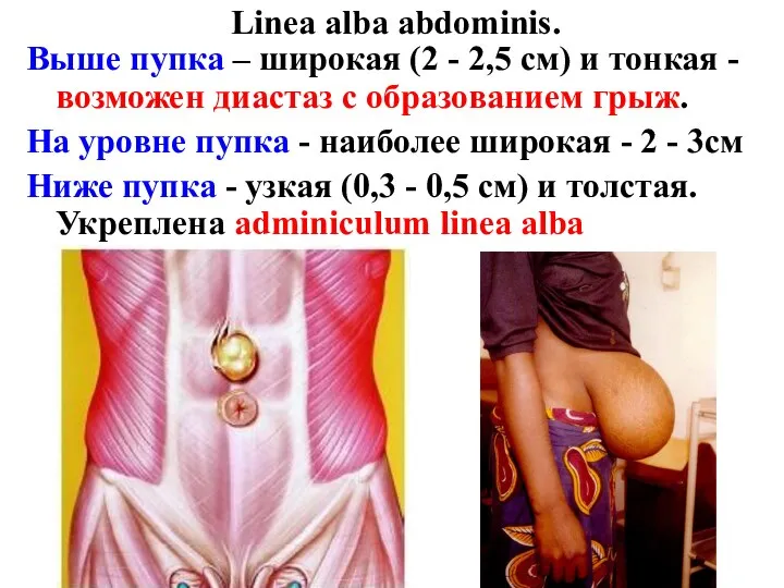 Linea alba abdominis. Выше пупка – широкая (2 - 2,5 см)