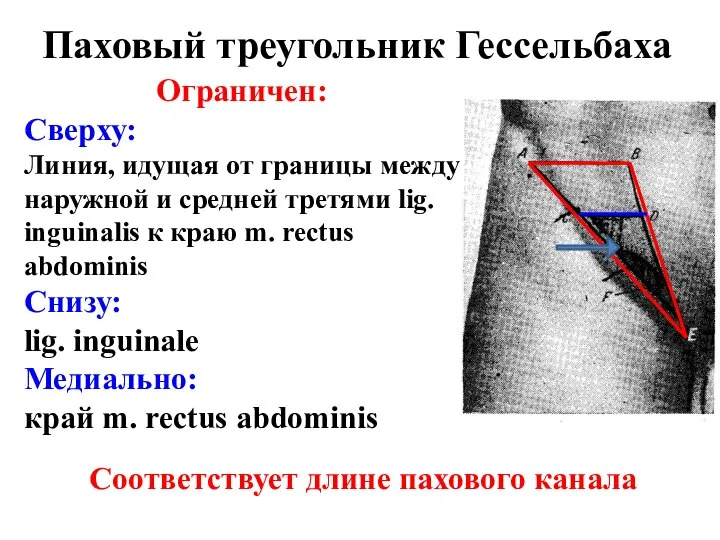 Ограничен: Сверху: Линия, идущая от границы между наружной и средней третями