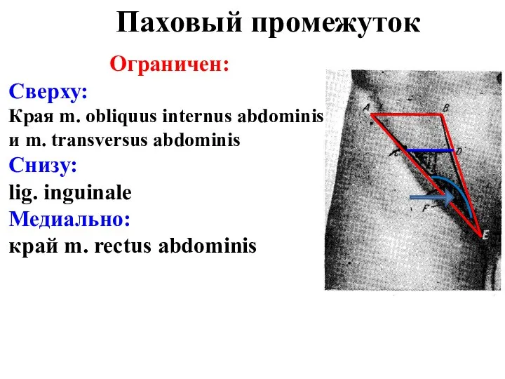 Ограничен: Сверху: Края m. obliquus internus abdominis и m. transversus abdominis
