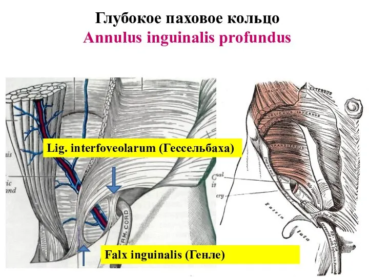 Глубокое паховое кольцо Annulus inguinalis profundus Lig. interfoveolarum (Гессельбаха) Falx inguinalis (Генле)