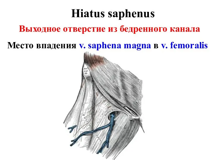 Hiatus saphenus Выходное отверстие из бедренного канала Место впадения v. saphena magna в v. femoralis