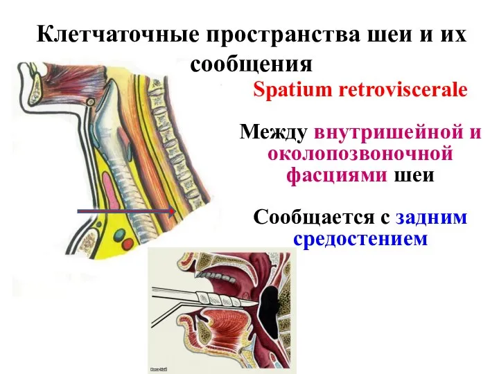 Клетчаточные пространства шеи и их сообщения Spatium retroviscerale Между внутришейной и