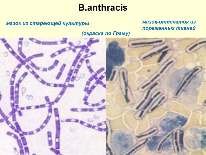 B.аnthracis мазок из стареющей культуры мазок-отпечаток из пораженных тканей (окраска по Граму))