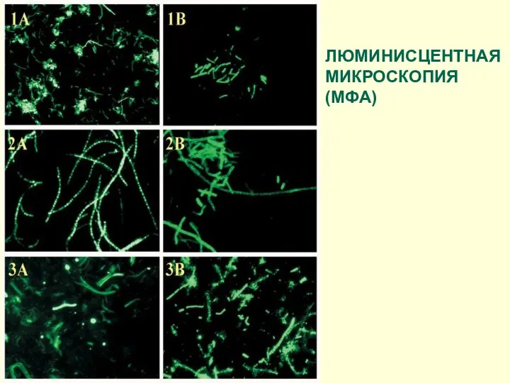 ЛЮМИНИСЦЕНТНАЯ МИКРОСКОПИЯ (МФА)