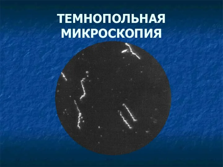 ТЕМНОПОЛЬНАЯ МИКРОСКОПИЯ