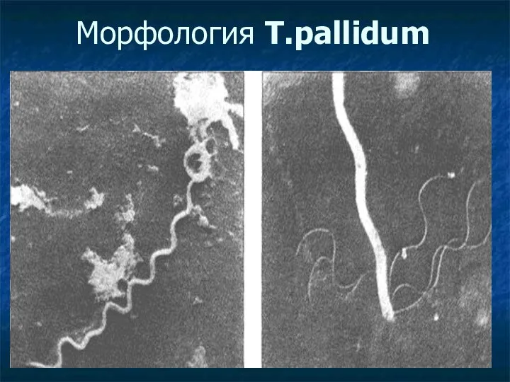 Морфология T.pallidum