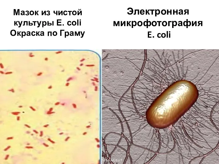 Электронная микрофотография E. coli Мазок из чистой культуры E. coli Окраска по Граму