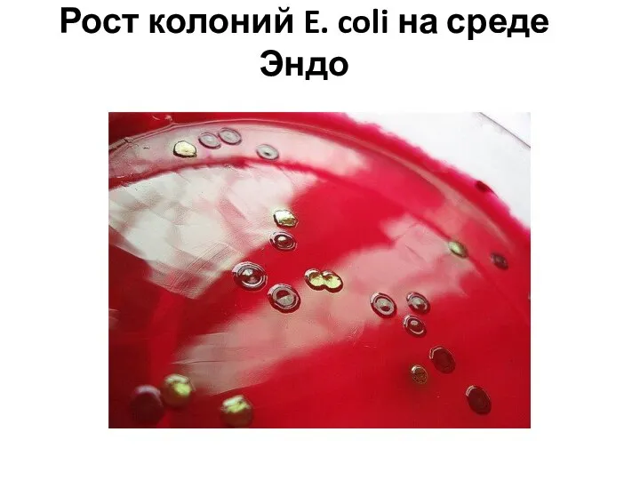 Рост колоний E. coli на среде Эндо