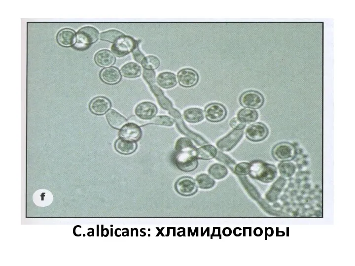 C.albicans: хламидоспоры