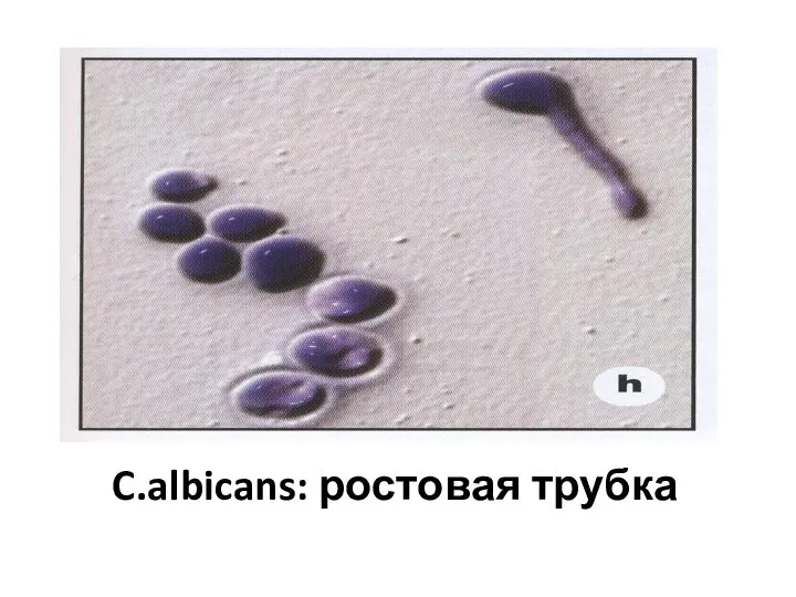 C.albicans: ростовая трубка