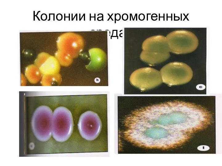 Колонии на хромогенных средах