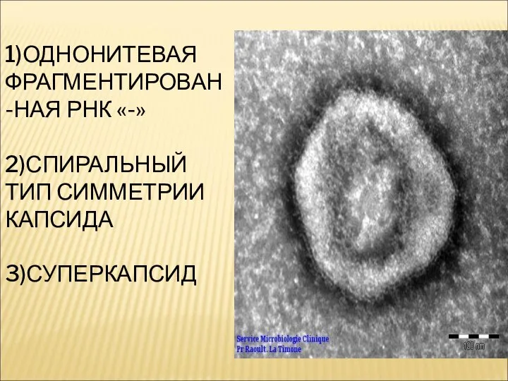 1)ОДНОНИТЕВАЯ ФРАГМЕНТИРОВАН-НАЯ РНК «-» 2)СПИРАЛЬНЫЙ ТИП СИММЕТРИИ КАПСИДА 3)СУПЕРКАПСИД