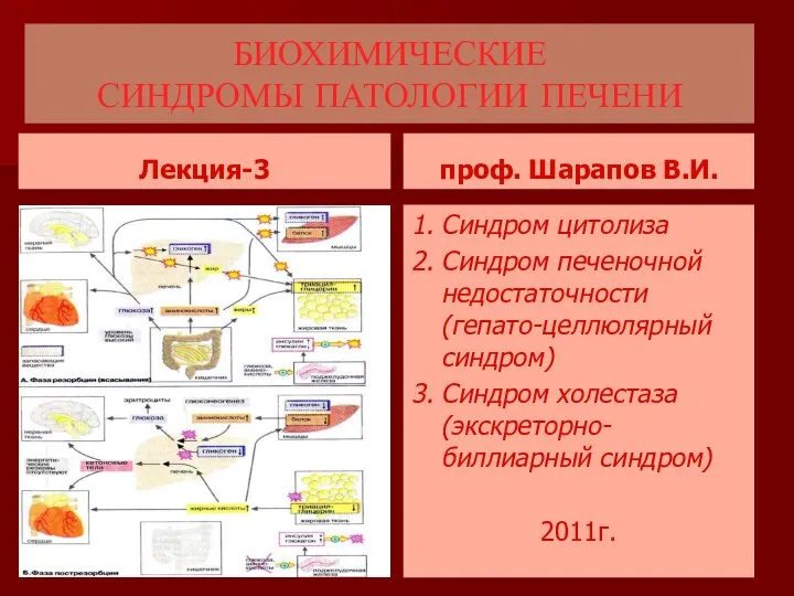 БИОХИМИЧЕСКИЕ СИНДРОМЫ ПАТОЛОГИИ ПЕЧЕНИ Лекция-3 проф. Шарапов В.И. 1. Синдром цитолиза