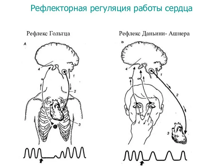 Рефлекс Гольтца Рефлекс Даньини- Ашнера Рефлекторная регуляция работы сердца