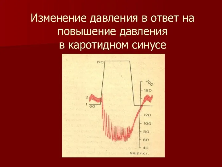 Изменение давления в ответ на повышение давления в каротидном синусе