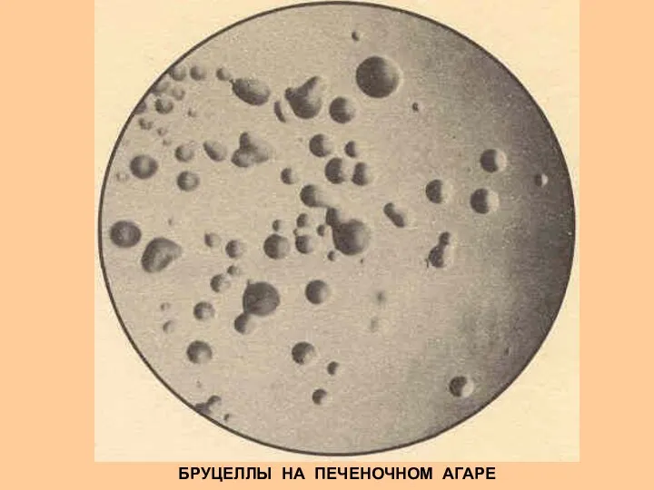 БРУЦЕЛЛЫ НА ПЕЧЕНОЧНОМ АГАРЕ