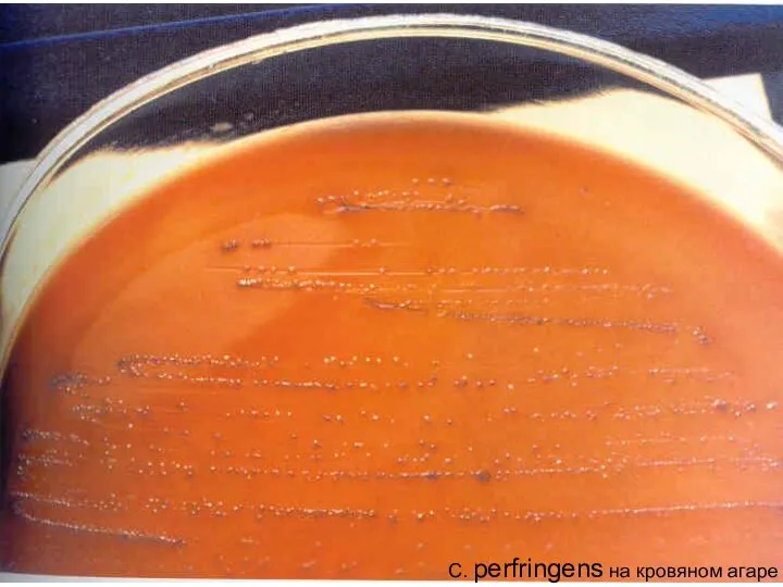 C. perfringens на кровяном агаре