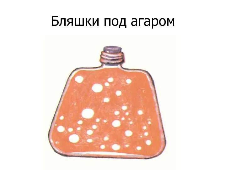 Бляшки под агаром