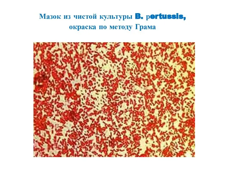 Мазок из чистой культуры B. рertussis, окраска по методу Грама