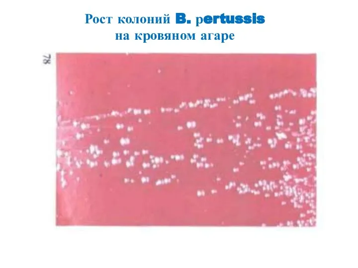 Рост колоний B. рertussis на кровяном агаре