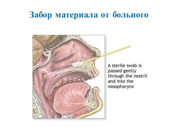 Забор материала от больного