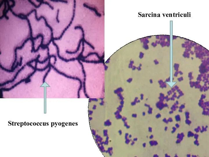 Streptococcus pyogenes Sarcina ventriculi