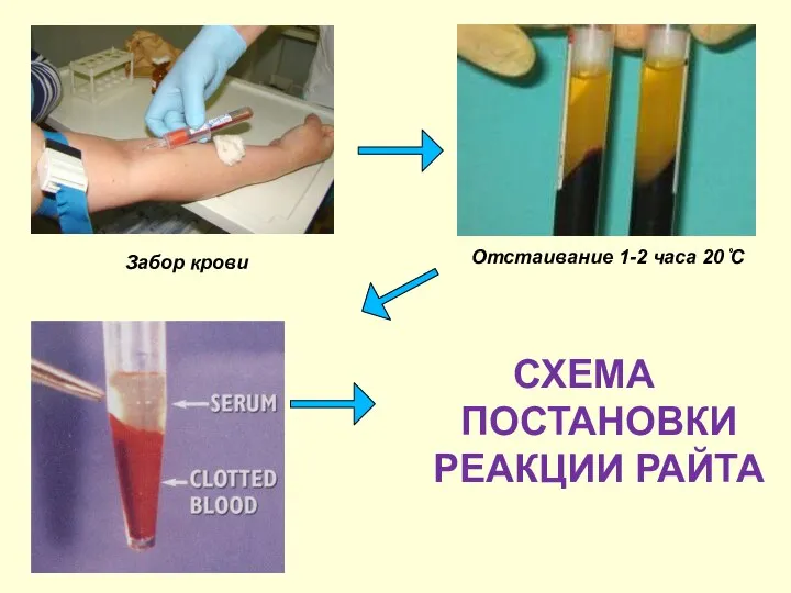 СХЕМА ПОСТАНОВКИ РЕАКЦИИ РАЙТА Отстаивание 1-2 часа 20 ̊С Забор крови