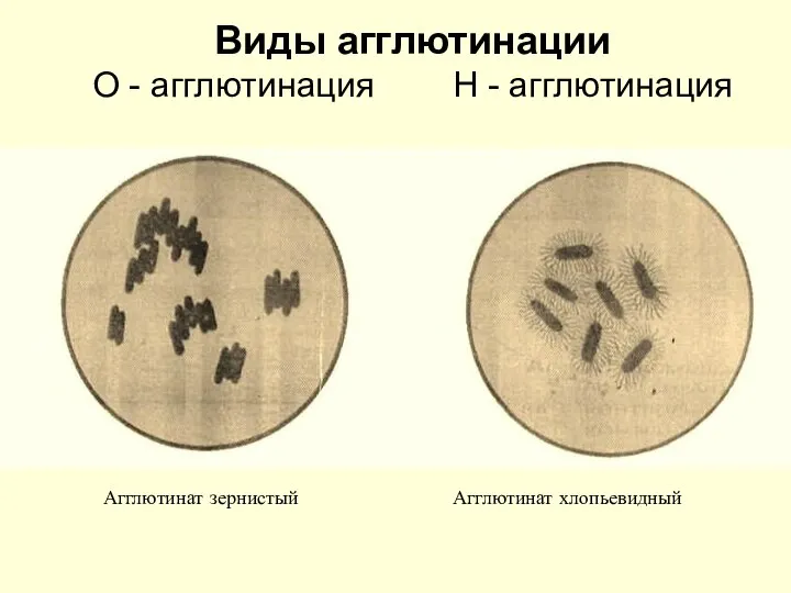 Виды агглютинации О - агглютинация Н - агглютинация Агглютинат зернистый Агглютинат хлопьевидный