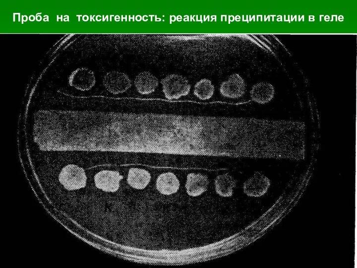 Проба на токсигенность: реакция преципитации в геле