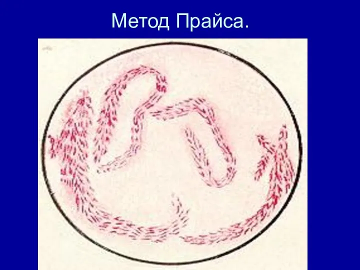 Метод Прайса.