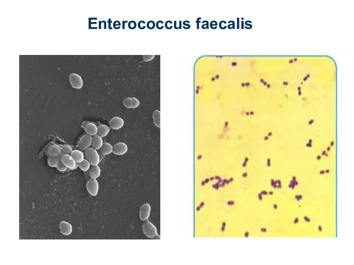 Enterococcus faecalis